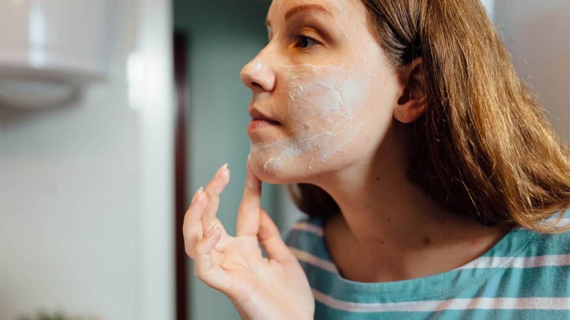 acne cream